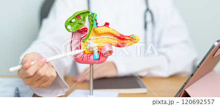 Doctor with human Pancreatitis anatomy model with Pancreas, Gallbladder, Bile Duct, Duodenum, Small intestine and tablet. Pancreatic cancer, acute pancreatitis and Digestive system 120692557