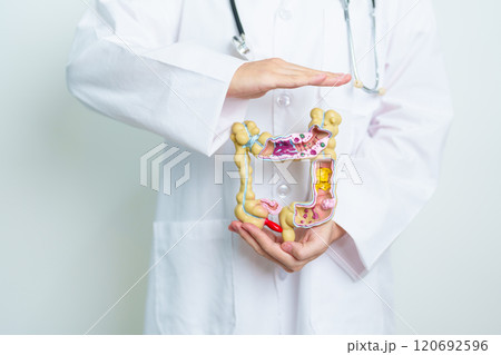 Doctor with human Colon anatomy model. Colonic disease, Large Intestine, Colorectal cancer, Ulcerative colitis, Diverticulitis, Irritable bowel syndrome, Digestive system and Health concept 120692596