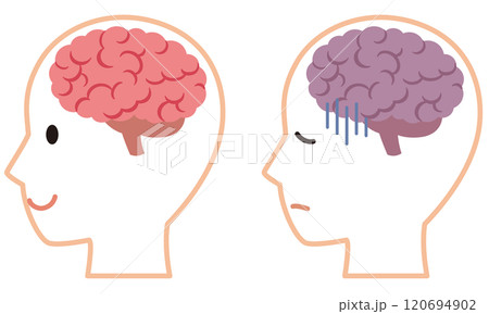 元気な脳とストレスを受けた脳　脳のイメージ　健康 120694902