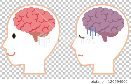 元気な脳とストレスを受けた脳　脳のイメージ　健康 120694902