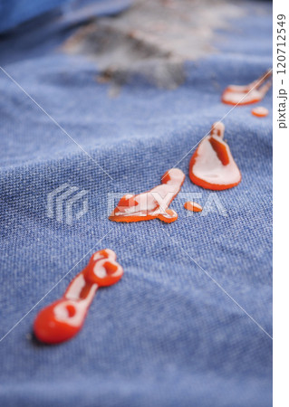 A nlue shirt was stained by spilled ketchup, requiring cleaning to remove the blot 120712549