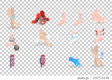3D Isometric Flat Set of Varicose Treatment, Health Care 3D Isometric Flat Set of Varicose Treatment, Health Care 120713238