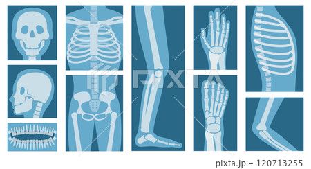 3D Isometric Flat Set of XRay Of Human Body Parts, Skeleton and Bones Scan 3D Isometric Flat Set of XRay Of Human Body Parts, Skeleton and Bones Scan 120713255