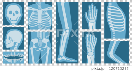3D Isometric Flat Set of XRay Of Human Body Parts, Skeleton and Bones Scan 3D Isometric Flat Set of XRay Of Human Body Parts, Skeleton and Bones Scan 120713255