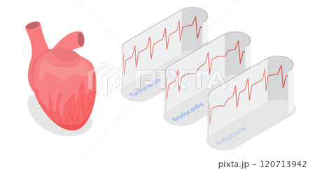 3D Isometric Flat  Illustration of Pathological Heart Rhythm Types, Electro-cardiogram 120713942