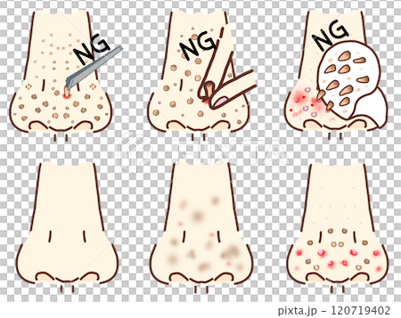 Nostril NG care, Beautiful nose, Troubled nose 120719402