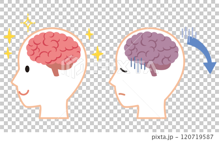 Healthy brain and stressed brain Brain image Health Healthy brain and stressed brain Brain image Health 120719587