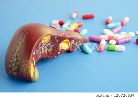Liver model with pill drug treatment, Cirrhosis, Liver cancer, fatty liver. 120726634