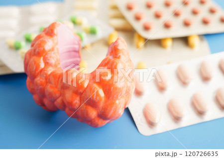 Thyroid model with pill drug treatment, Hyperthyroidism, Overactive or Lymphoma. 120726635