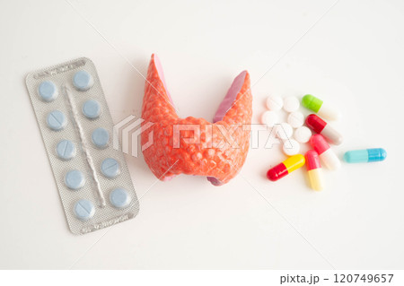 Thyroid model with pill drug treatment, Hyperthyroidism, Overactive or Lymphoma. Thyroid model with pill drug treatment, Hyperthyroidism, Overactive or Lymphoma. 120749657