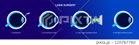 LASIK eye surgery LASIK eye surgery 120767760