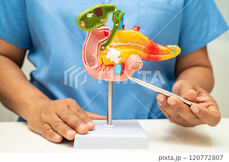 Pancreatitis, pancreatic cancer, Asian doctor with pancreas, gallbladder and bile duct human anatomy model at hospital. Pancreatitis, pancreatic cancer, Asian doctor with pancreas, gallbladder and bile duct human anatomy model at hospital. 120772807