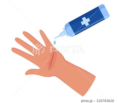 Bleeding cut on the palm, emergency situation. First aid treatment for wound on skin. Trauma, treatment procedure. Vector illustration. Bleeding cut on the palm, emergency situation. First aid treatment for wound on skin. Trauma, treatment procedure. Vector illustration. 120783620