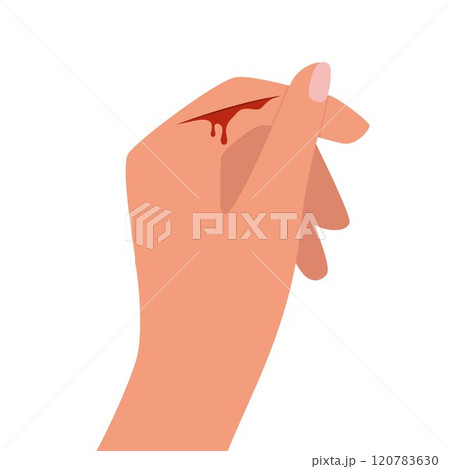 Bleeding cut on the palm, emergency situation. First aid treatment for wound on skin. Trauma, treatment procedure. Vector illustration. 120783630