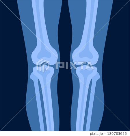 Xray of human knees bones and joints, examination and diagnosis. Healthcare and rheumatism analysis, physical care in hospital or clinics. Vector illustration. Xray of human knees bones and joints, examination and diagnosis. Healthcare and rheumatism analysis, physical care in hospital or clinics. Vector illustration. 120783656