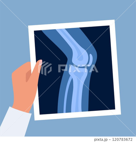 X-ray anatomy of the knee joint and human leg. Roentgen shot in doctors hand. Vector illustration. X-ray anatomy of the knee joint and human leg. Roentgen shot in doctors hand. Vector illustration. 120783672