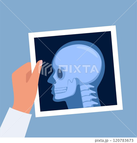 X-ray shot of skull, human body, head and neck bones side view, radiography. Roentgen shot in doctors hand. Vector illustration. 120783673