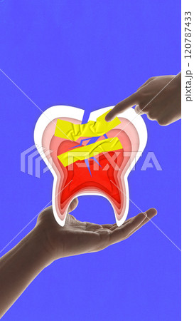 Contemporary art collage. Cracked tooth with yellow tape and hands pointing at it, symbolizing dental problems and repair. against blue background. 120787433