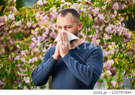 Man allergic suffering from seasonal allergy at spring in blossoming garden at springtime. Man sneezing and blowing nose using nasal handkerchief in front of blooming tree. Spring allergy concept. Man allergic suffering from seasonal allergy at spring in blossoming garden at springtime. Man sneezing and blowing nose using nasal handkerchief in front of blooming tree. Spring allergy concept. 120793984
