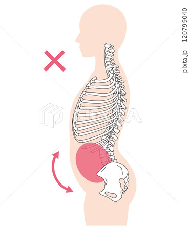 肋骨の開き　反り腰　正しい姿勢と反り腰の姿勢 120799040