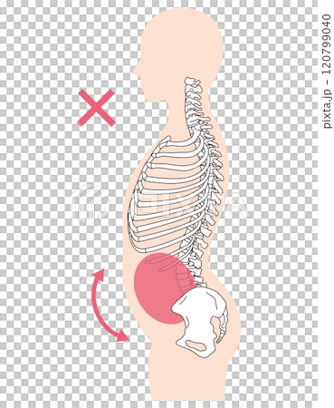 肋骨の開き　反り腰　正しい姿勢と反り腰の姿勢 120799040