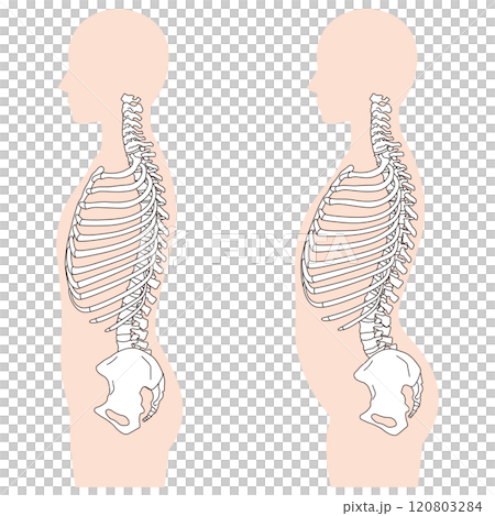 Rib gap, arched back, correct posture and arched back posture Rib gap, arched back, correct posture and arched back posture 120803284