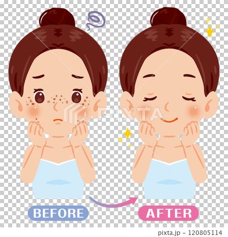一個有雀斑和斑點的女人前後的插圖 一個有雀斑和斑點的女人前後的插圖 120805114