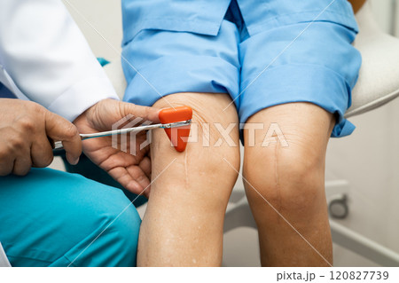 Asian doctor use hammer knock senior woman patient to check knee reflex, nerve and muscle in hospital. Asian doctor use hammer knock senior woman patient to check knee reflex, nerve and muscle in hospital. 120827739