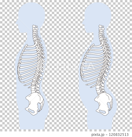 Rib gap, arched back, correct posture and arched back posture 120832513