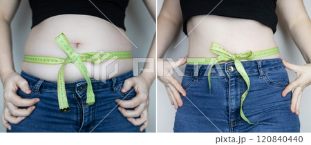 Woman before and after weight loss, weight loss. Abdominoplasty or diet aftereffect. Belly tied with measuring tape in the form of a bow 120840440