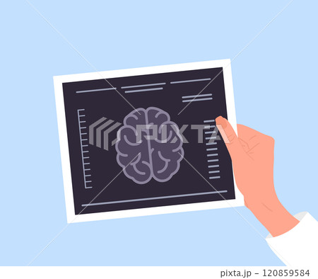 MRI scan. Female hand holding result of Magnetic resonance imaging. Brain diseases. Health care and treatment concept. Vector illustration in flat cartoon style 120859584