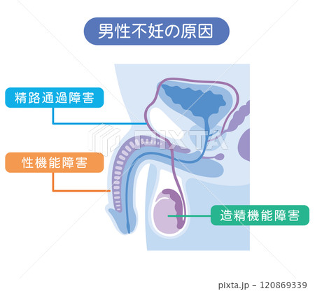 男性不妊の原因 不妊症 生殖医療 男性不妊の原因 不妊症 生殖医療 120869339