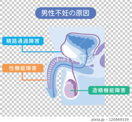男性不妊の原因 不妊症 生殖医療 男性不妊の原因 不妊症 生殖医療 120869339