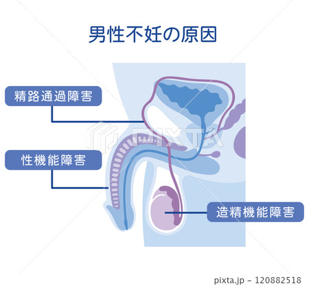 男性不妊の原因　不妊症　生殖医療 120882518