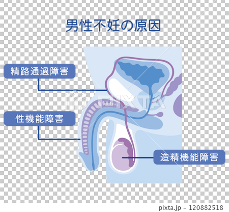男性不妊の原因　不妊症　生殖医療 120882518