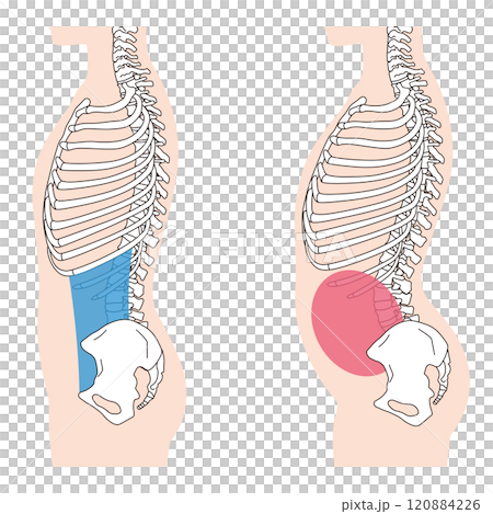 肋骨の開き　反り腰　正しい姿勢と反り腰の姿勢 120884226