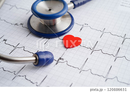 Stethoscope on electrocardiogram (ECG), heart wave, heart attack, cardiogram report. Stethoscope on electrocardiogram (ECG), heart wave, heart attack, cardiogram report. 120886631