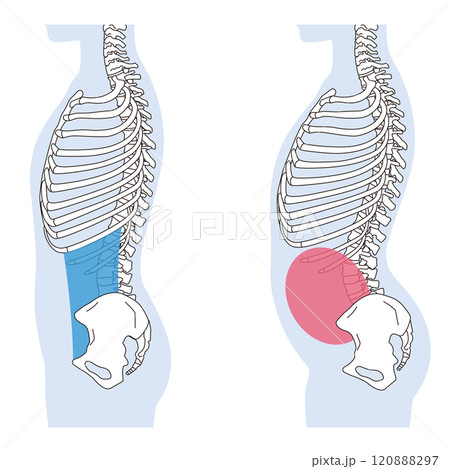 肋骨の開き 反り腰 正しい姿勢と反り腰の姿勢 肋骨の開き 反り腰 正しい姿勢と反り腰の姿勢 120888297