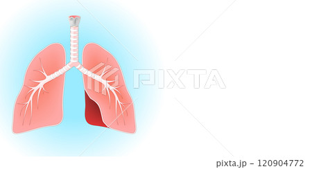 lungs, trachea, larynx, and bronchi on blue and white background 120904772