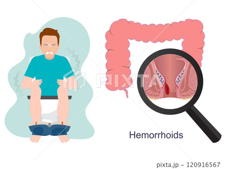 Man sitting on toilet feeling pain. Man sitting on toilet feeling pain. 120916567