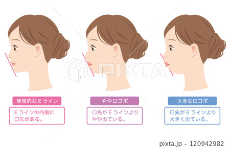 理想的なEラインと 口ゴボのEライン 横顔 理想的なEラインと 口ゴボのEライン 横顔 120942982