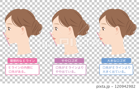 理想的なEラインと 口ゴボのEライン 横顔 理想的なEラインと 口ゴボのEライン 横顔 120942982