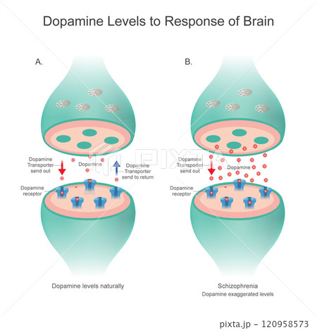 Dopamine Levels to Response of Brain. Dopamine Levels naturally and Dopamine levels in patient. 120958573