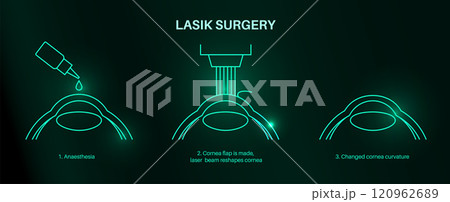 LASIK eye surgery LASIK eye surgery 120962689