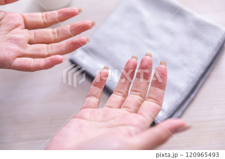手荒れ Rough hands 手荒れ Rough hands 120965493