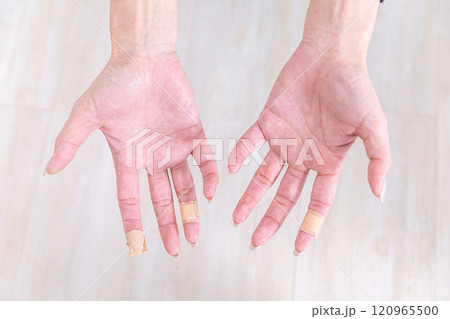 手荒れ　Rough hands 120965500