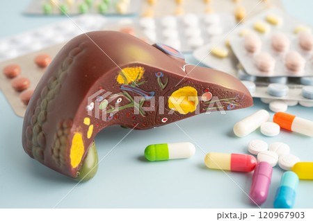 Liver model with pill drug treatment, Cirrhosis, Liver cancer, fatty liver. 120967903