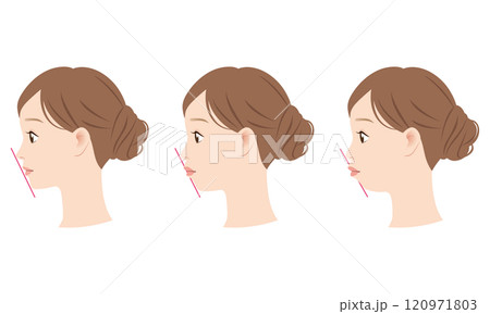 理想的なEラインと 口ゴボのEライン 横顔 理想的なEラインと 口ゴボのEライン 横顔 120971803