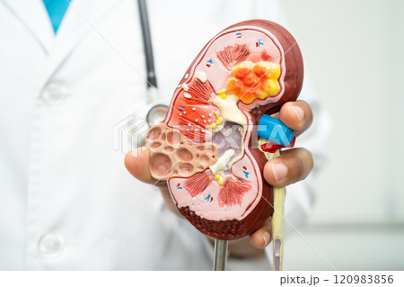 Cardiovascular disease CVD, Asian doctor holding human anatomy model for learn and treat heart disease. 120983856