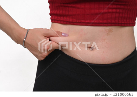 Young woman captures excess fat on her belly 121000563